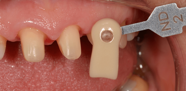 Eine komplexe Restauration und ein schlüssiges Konzept