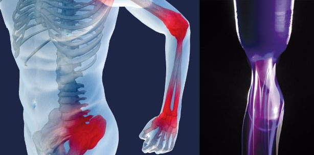 Gesundheitsrisiken durch Komposite