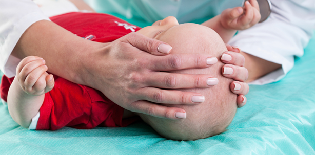 3-D-Druck verbessert Behandlung von Schädeldeformationen