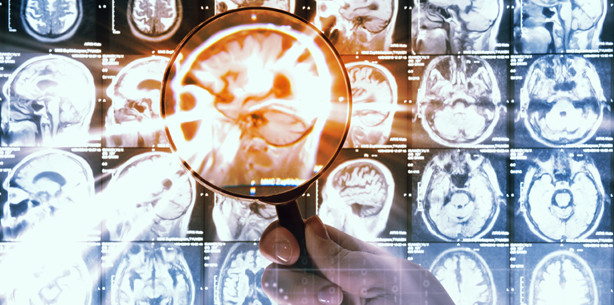 Viel Karies = wenig Krebs?