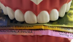 Kosten in der Schweiz steigen