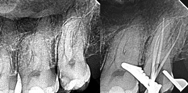 Erst Ausformung, dann Reinigung
