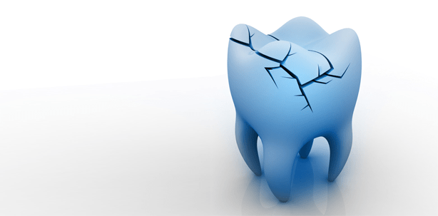 Einen kriminellen Zahn zuviel ausgebissen