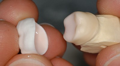 Ästhetik im Wechselbad der Technik