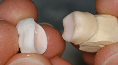 Ästhetik im Wechselbad der Technik