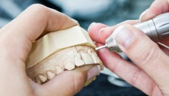 Vertrag zur Bindung an ein Dentallabor verstößt gegen Berufsrecht
