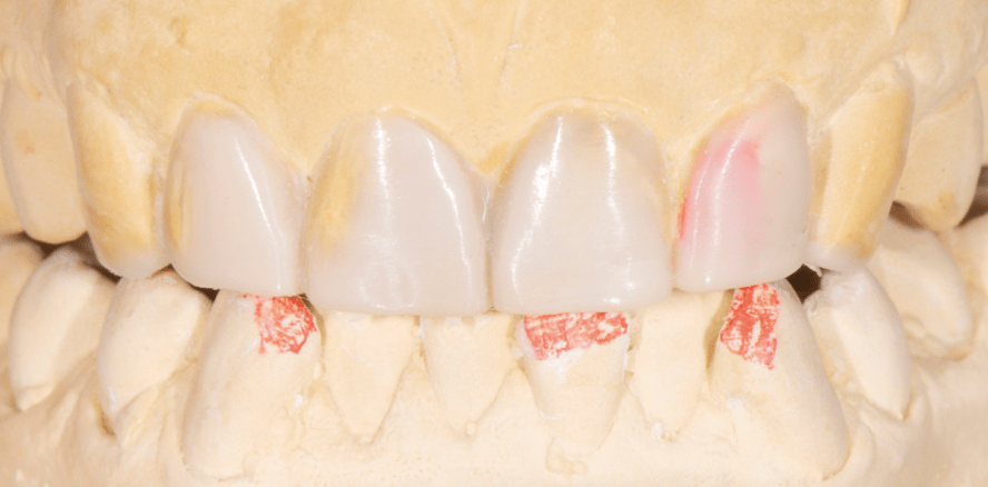 Langzeiterfolg in Funktion und Ästhetik