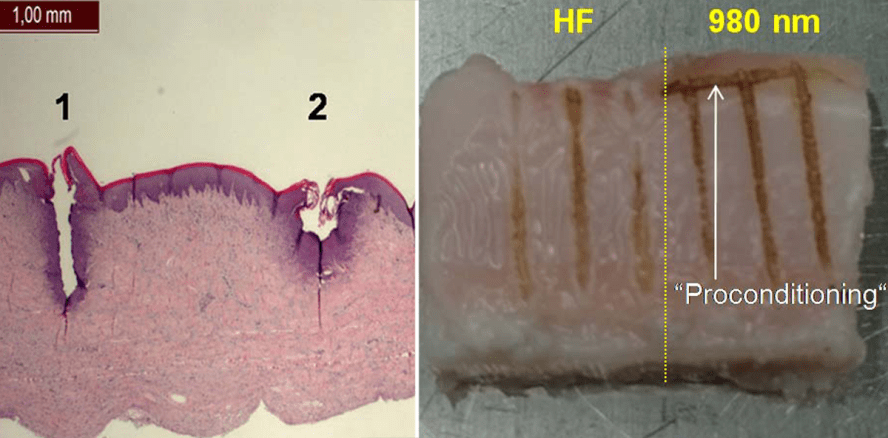 Neues Diodenlasersystem im blauen Lichtspektrum