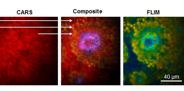 Lasertechnologie erleichtert Tests der Kosmetikindustrie