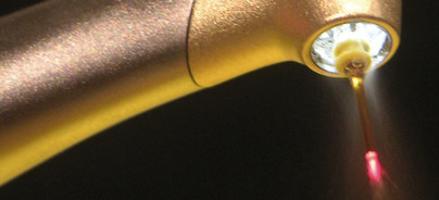 Kavitätenpräparation mit dem Er,Cr:YSGG-Laser