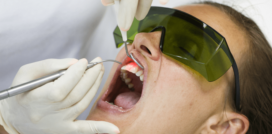 Laserbasierte Sterilisation von Zahnfleischtaschen – Anspruch auf Beihilfe?