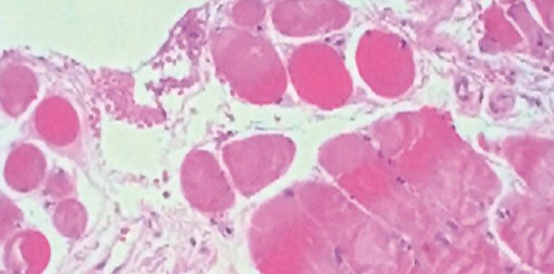 Diodenlaser und Hochfrequenztechnik in der oralen Anwendung