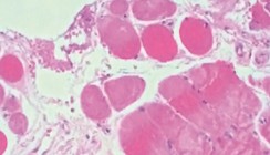 Diodenlaser und Hochfrequenztechnik in der oralen Anwendung