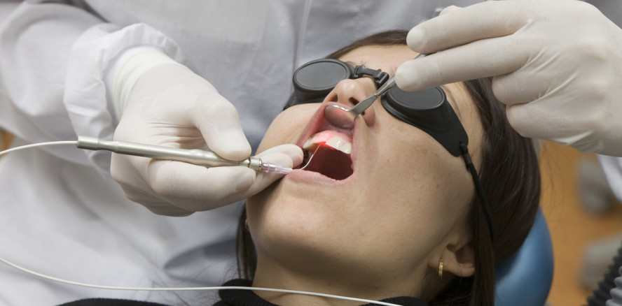 So effektiv ist die Laserbehandlung in der Zahnmedizin