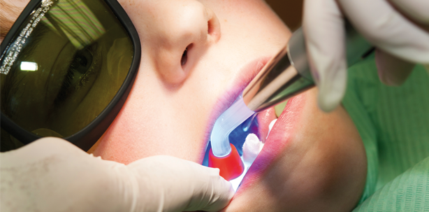 Laserschutzbrillen – kurz und bündig