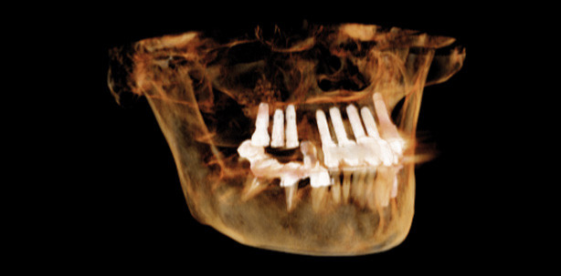 State of the Art beim 2-D-/3-D-Röntgen in der täglichen Praxis