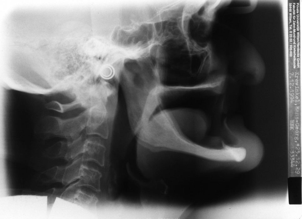 Die Biologische Augmentation