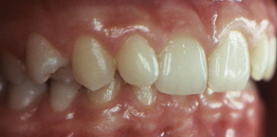 Lingualtechnik in Labor und Praxis