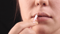 Anfassen verboten – Lippenherpes überträgt sich schnell