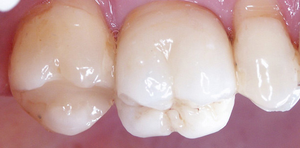 Von der Pflicht zur Kür