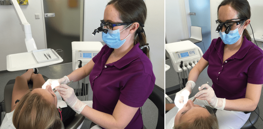 Einsatz einer Lupenbrille während der Prophylaxesitzung