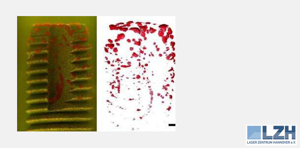 Neues Laserverfahren spürt Bakterien auf Implantaten auf