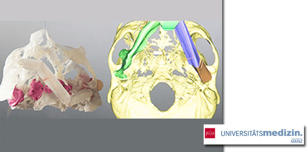 Nicht geklont, aber rekonstruiert: 3-D-Drucker „kopiert“ Körperteile