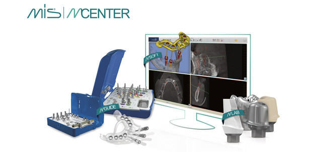 MCENTER Europe bietet Service für Implantatplanung und -prothetik