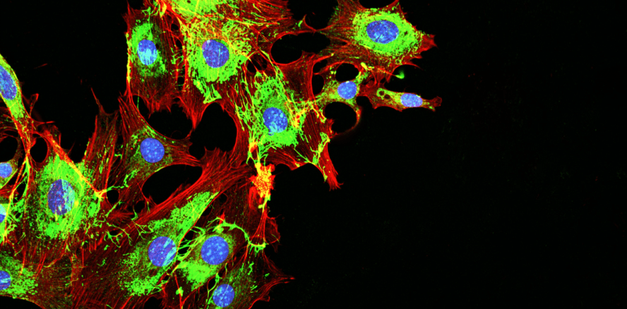 Melanome: Mit Avataren Schlupfwege von Krebszellen finden