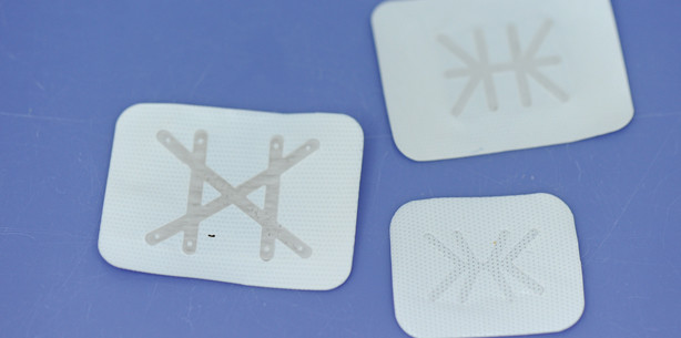 20 Jahre membrangeschützte Knochen­regeneration