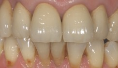 Quo vadis Verblendung?