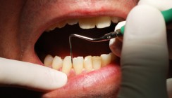 Diabetes-Medikament wirksam gegen Parodontitis