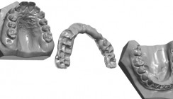 MExPERT Superlign®