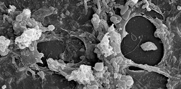 Zahnheilkunde – ein risikoreiches Behandlungsfeld