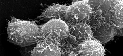 Regeneration des Zahnhalteapparats durch autologe Stammzellen