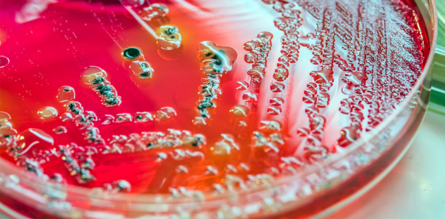 Mit Mikroben zur schnelleren Parodontitisdiagnose