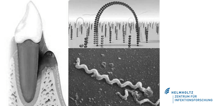 Mikrobiom der Zahntaschen spielt zentrale Rolle bei Parodontitis