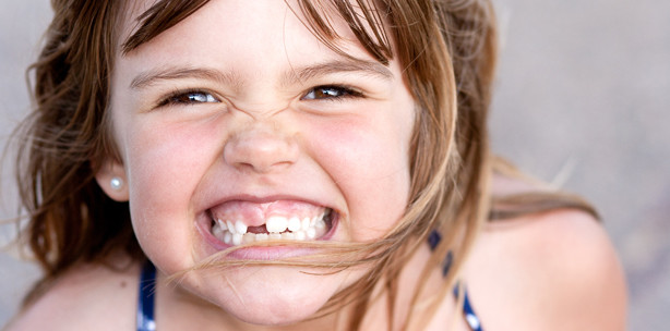 Au Backe: Kindern bröckeln die Zähne weg