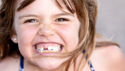 Au Backe: Kindern bröckeln die Zähne weg