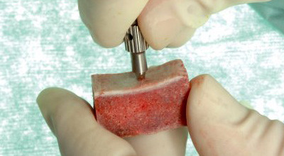 Komplikationen und Risiken