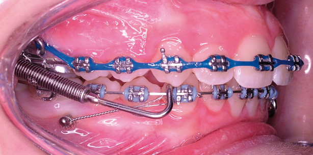 ﻿﻿﻿„Eine absolute Verankerung gibt es nicht“
