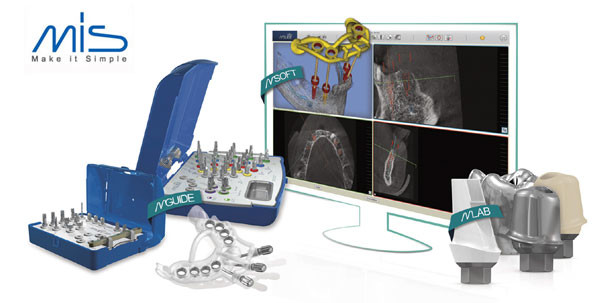 MIS Implants: „Wir vereinfachen die Implantologie“