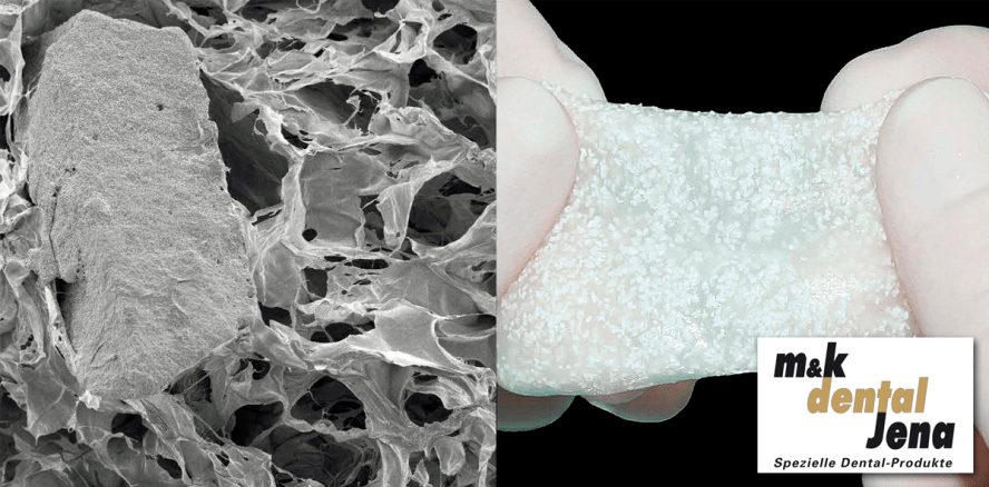Bessere Knochenregeneration – geringere Immunreaktion und Fibroserate
