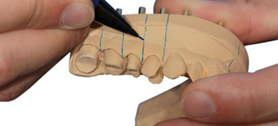 Zeitgemäß und präzise: Ein Modellsystem im Anwenderbericht