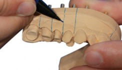 Zeitgemäß und präzise: Ein Modellsystem im Anwenderbericht