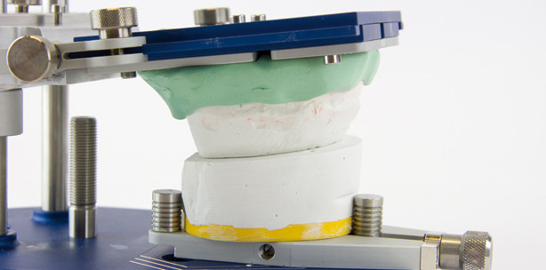 Einfach und präzise: das Surgical Model Accuracy Device