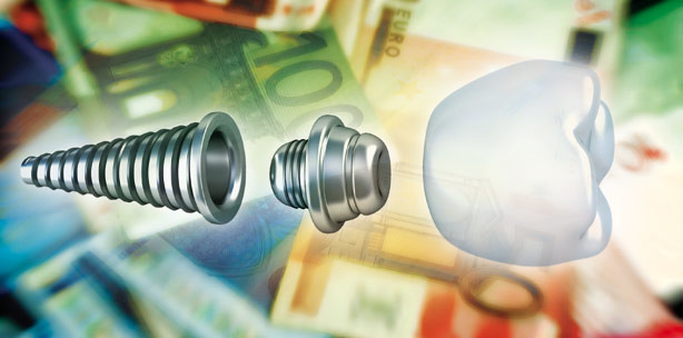 Implantologie bringt Praxen über 3 Milliarden €