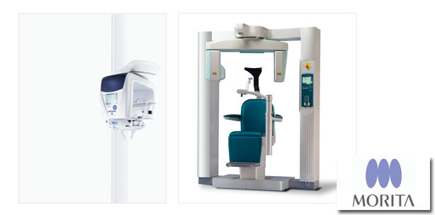 Schonend und gestochen scharf: Moderne Diagnostik in der Implantologie