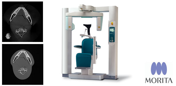 Japanische Innovationskraft auf Deutschem Röntgenkongress