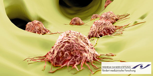 Forscher entdecken "Motor" für Metastasen